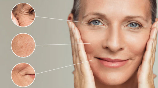 Fraxel 1550 Laser Skin Resurfacing (3 sessions)